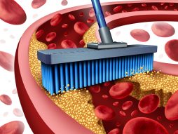 grafički prikaz kako metla čisti holesterol iz arterije