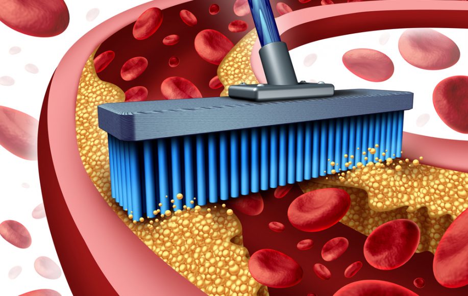 grafički prikaz kako metla čisti holesterol iz arterije