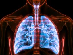 pluća rentgen snimak