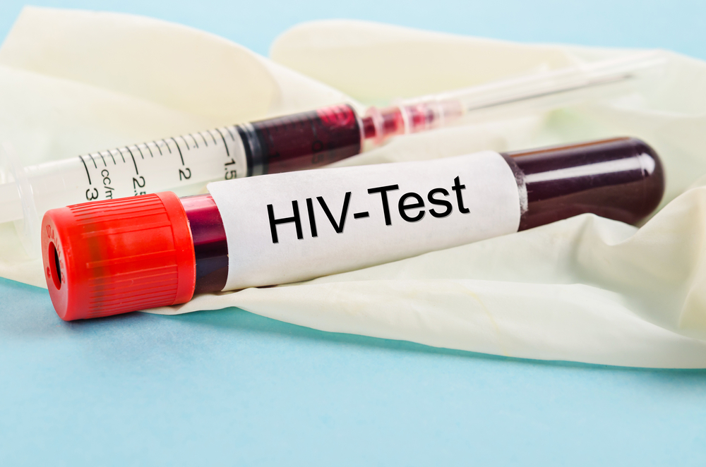 test na HIV