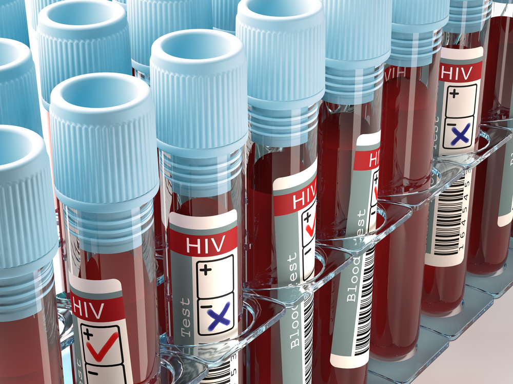 uzoci krvi pozitivni na HIV