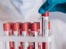 uzorci krvi testirani na korona virus