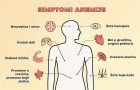 simptomi anemije grafika