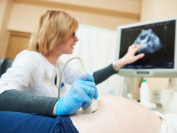 pregled bebe ultrazvukom