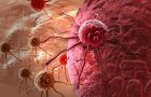 rak-karcinom-celije