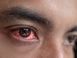 crveno oko-bolest-povreda