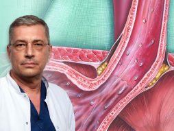 Prof dr Aleksandar Simić, digestivni hirurg, I hirurčka klinika, jednjak