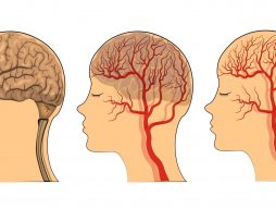 mozak-krvotok-gojaznost