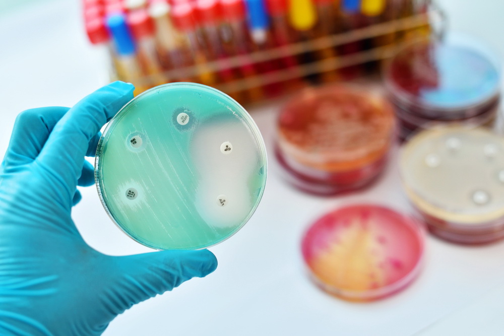 antimikrobi-infekcije-bakterije 