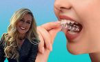 bruksizam-škripanje zubima-škrgutanje zubima