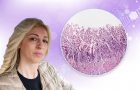 Dr Ana Kalaba-Dijagnoza- autoimuni atrofični gastritis
