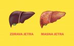 jetra-masna jetra-poremećaj metabolizma masti