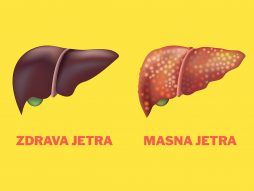 jetra-masna jetra-poremećaj metabolizma masti