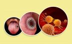zdravlje usta- dijabetes- karcinom usta-karcinom grla