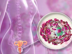 Bakterijska vaginoza- zdravljevagine- vaginalna mikrosredina