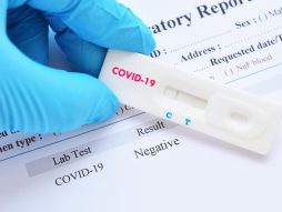 pcr test- covid test - korona virus-zdravstvena propusnica