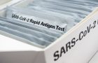 brzi antigenski test - ovlašćene laboratorije- mikrobiloške laboratorije
