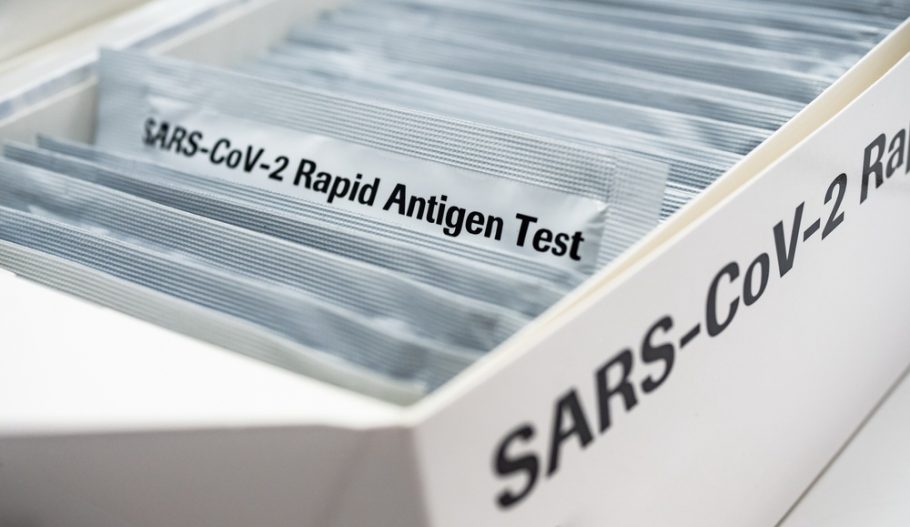 brzi antigenski test - ovlašćene laboratorije- mikrobiloške laboratorije