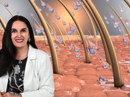 Opadanje kose, dr Svetlana Popadić