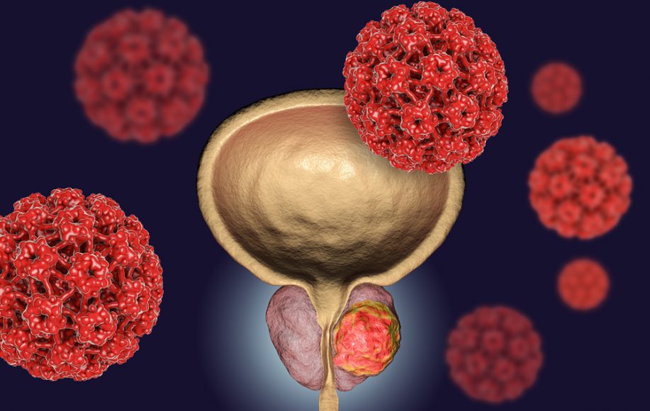 Karcinom prostate, ejakulacija