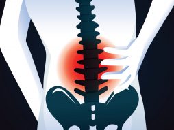 bol u leđima- degeneracija diska- opioidi