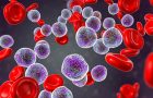 leukemija- limfomi- rak krvih ćelija