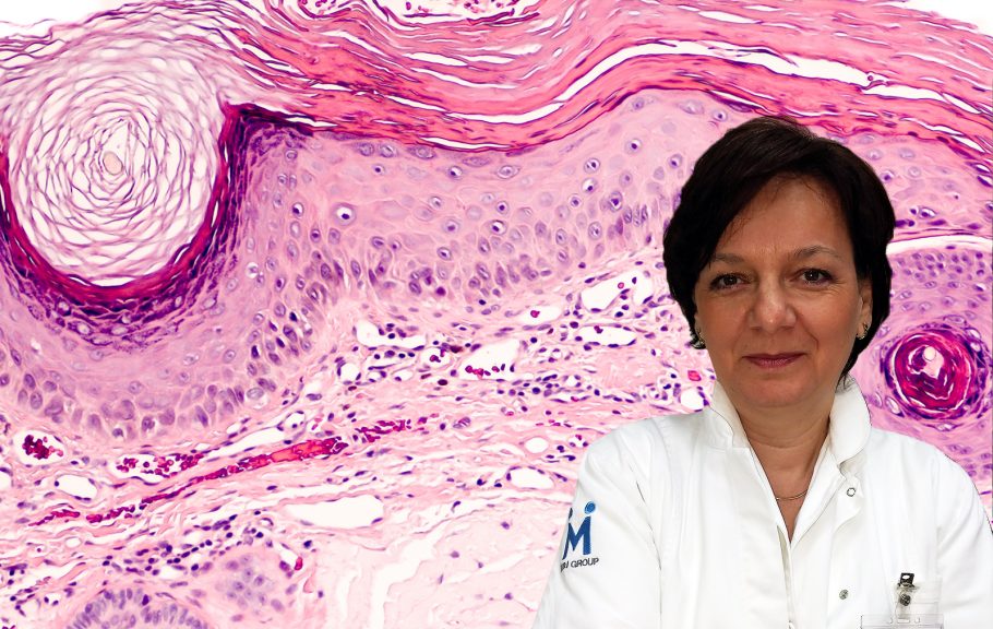 Dr Snežana Radanović, biopsija kože