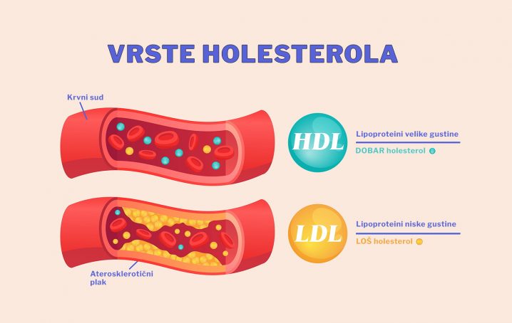 Dobar I Loš Holesterol - Kako Se Označavaju U Analizama I Koja Je ...