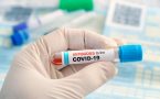 test antitela-pasterov zavod-srpska vakcina za covid 19