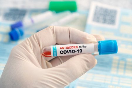 test antitela-pasterov zavod-srpska vakcina za covid 19