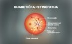 dijabetička retinopatija- slepilo- vid