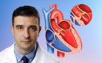 srce aortna stenoza