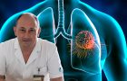 Skrining raka pluća
