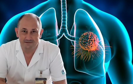 Skrining raka pluća