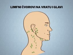 Otečeni limfni čvorovi na vratu