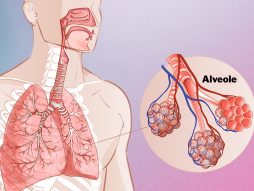 Paraseptalni emfizem pluća