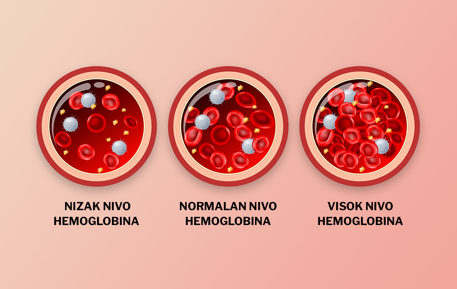 Concentración de la hemoglobina corpuscular media