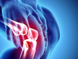 Simptomi koiji ukazuju na artritis kolena