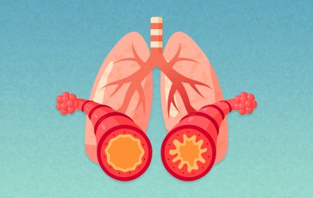 osobe sa astmom
