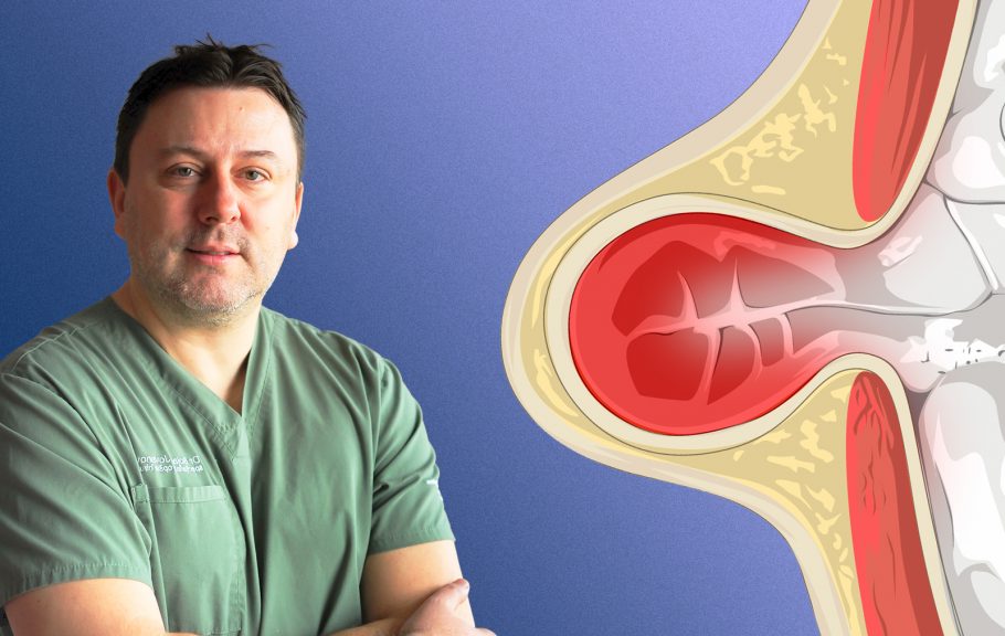 Preponska kila, dr Bojan Jovanović