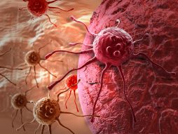 Rak i kako ga prevenirati