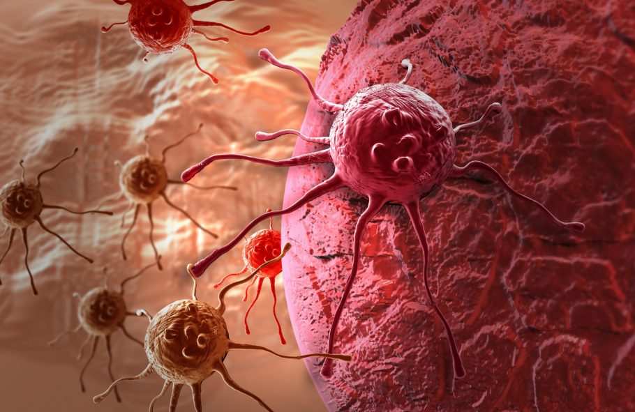 Rak i kako ga prevenirati