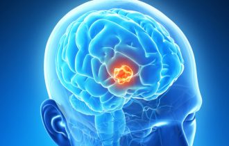 Otkriveno kako smrtonosni rak mozga „zaobilazi“ tretmane lečenja
