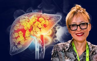 Jedna opasna bolest jetre brže se razvija kod žena nego kod muškaraca