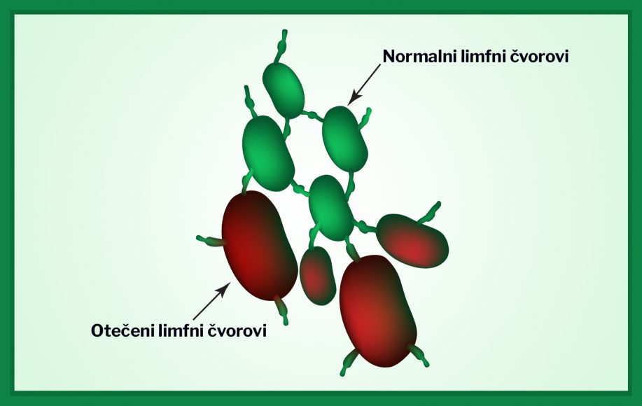 limfni čvorovi