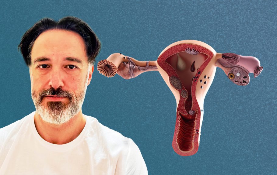 Endometrioza dr Goran Gavrilović