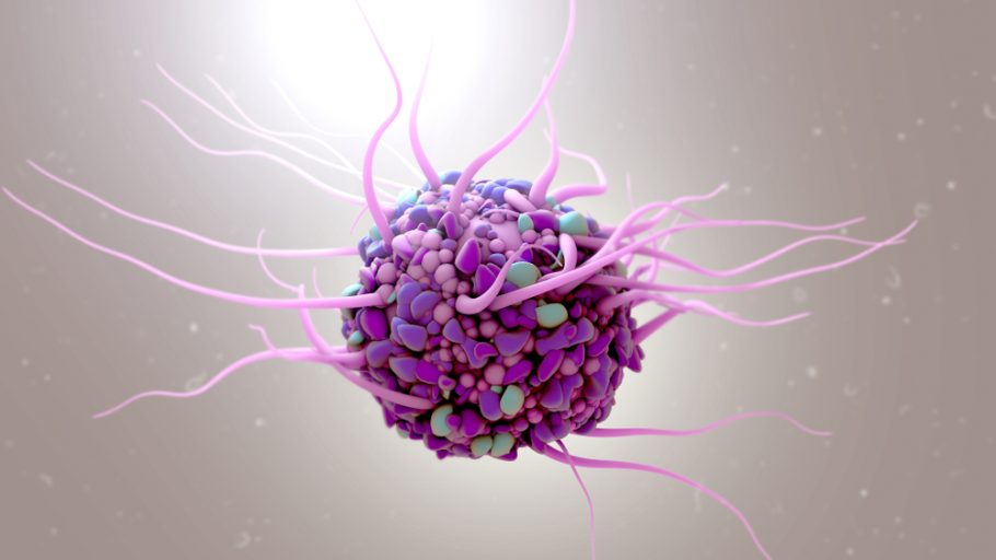 tumorske ćelije