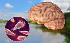 ameba koja jede mozak