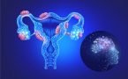 žene sa endometriozom
