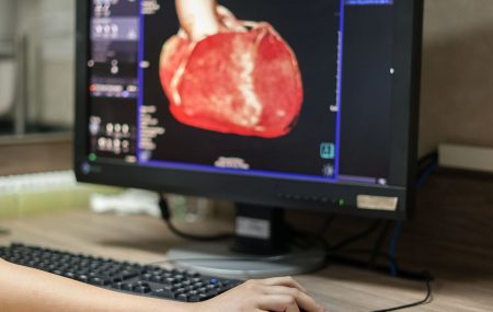 kompjuterizovana tomografska angiografija (CTA)